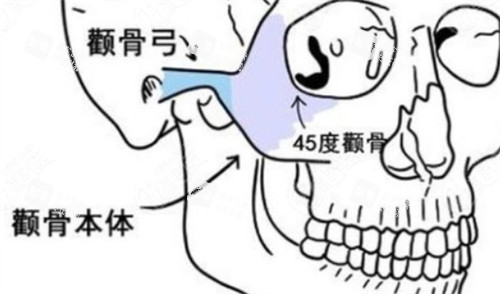 颧骨颧弓所在位置