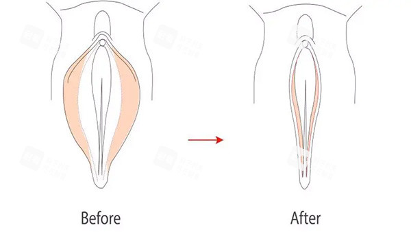 苏州私密整形哪家好？圣爱整形高新区金山路分院，项目齐全就近就诊更安心！