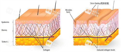 热拉提原理 热拉提原理