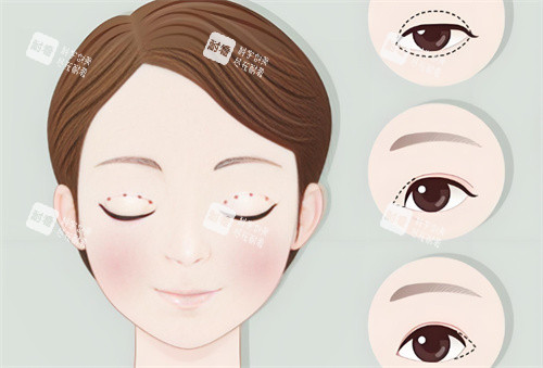 双眼皮卡通动画图 双眼皮卡通动画图
