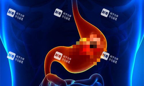 胃部病变展示图 胃部病变展示图