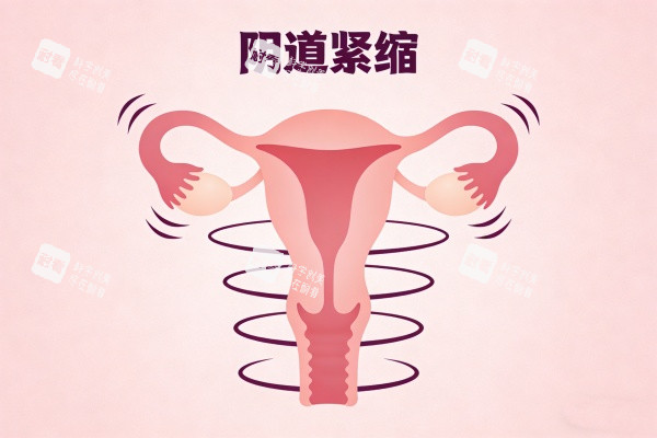 阴道紧缩卡通图展示