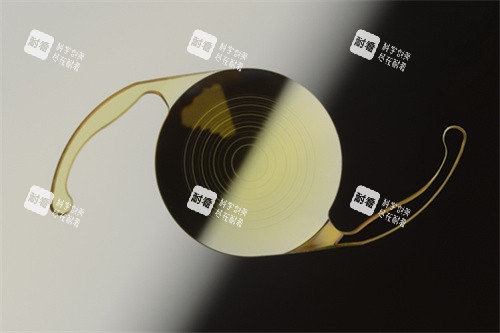 三焦点人工晶体价格 三焦点人工晶体价格