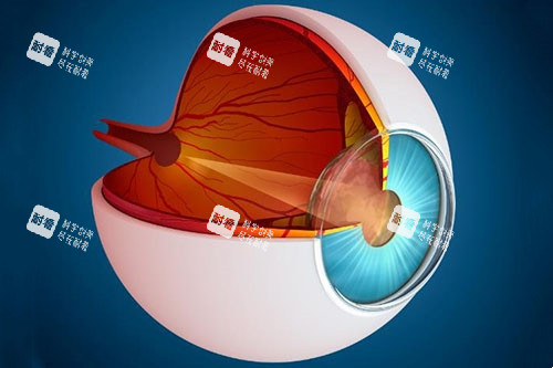 青光眼侧面解刨图片 青光眼侧面解刨图片