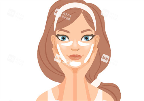 面部提升注射区域 面部提升注射区域