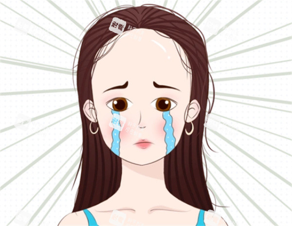 发际线植发卡通图 发际线植发卡通图