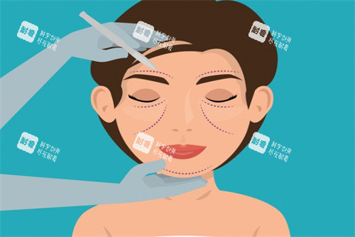 面部提升卡通图