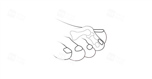 二脚趾过长透视图