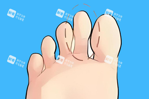 二脚趾长卡通图