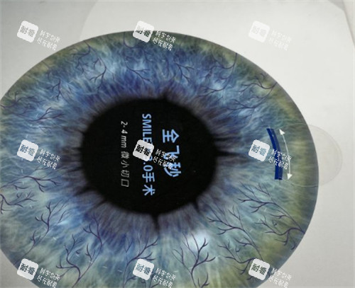 济南麦迪格眼科全飞秒手术介绍 济南麦迪格眼科全飞秒手术介绍