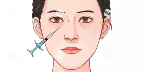 泪沟注射填充位置展示动画图