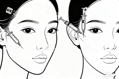 面部注射图片一览
