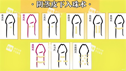 阴茎皮下入珠术 阴茎皮下入珠术