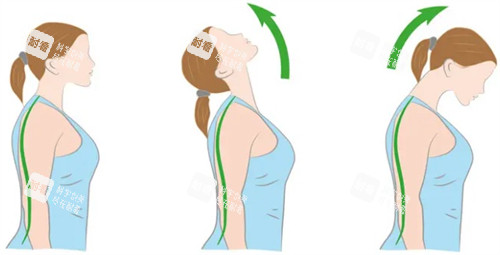 少低头能减少颈纹 少低头能减少颈纹