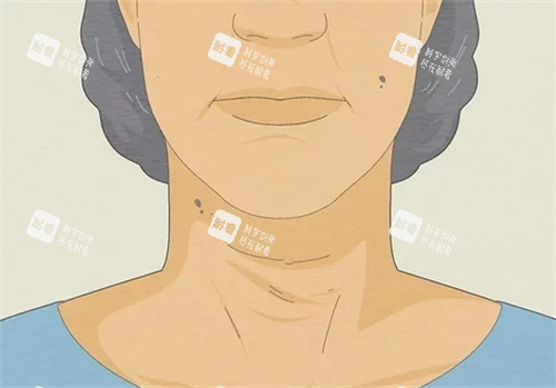 显老的颈纹 显老的颈纹