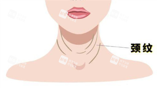颈纹动画 颈纹动画
