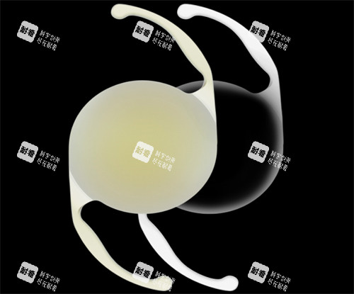 爱尔康人工晶体展示图