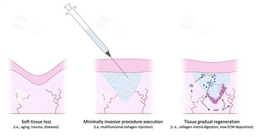 不明注射物 不明注射物