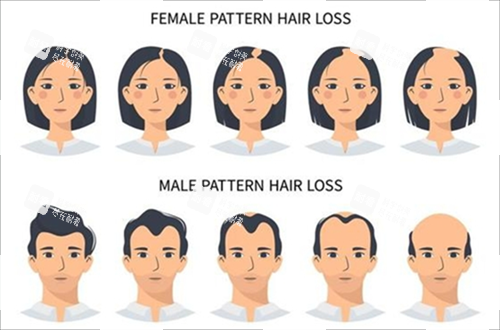 男女生发际线对比