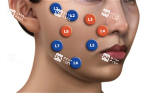 乔雅登不同点位注射方法