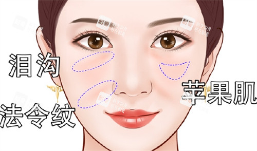 面部凹陷之后所呈现的面部状态 面部凹陷之后所呈现的面部状态