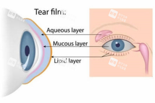 干眼手术 干眼手术