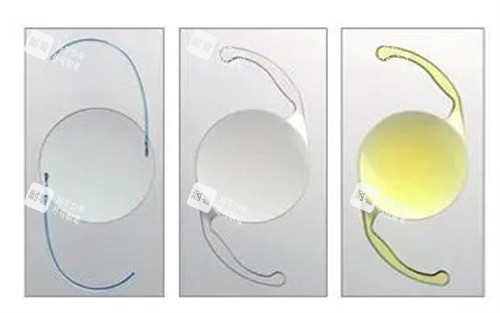 单焦点多焦点人工晶体 单焦点多焦点人工晶体