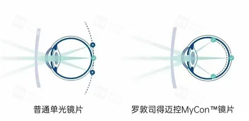 罗敦司得迈控镜片和普通镜片