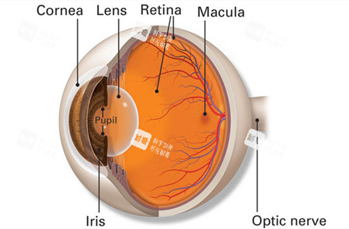 近视眼卡通图介绍 近视眼卡通图介绍