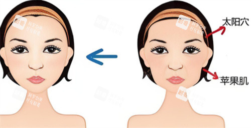 面部轮廓填充 面部轮廓填充