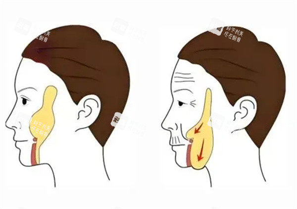 面部轮廓整形卡通图片 面部轮廓整形卡通图片