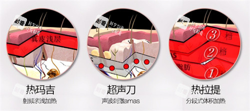 面部提升项目对比