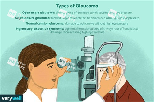 青光眼的类型 青光眼的类型