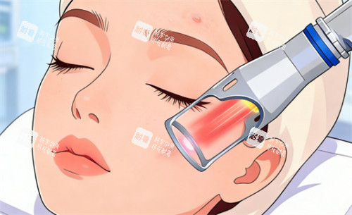 激光去疤有效吗 激光去疤有效吗