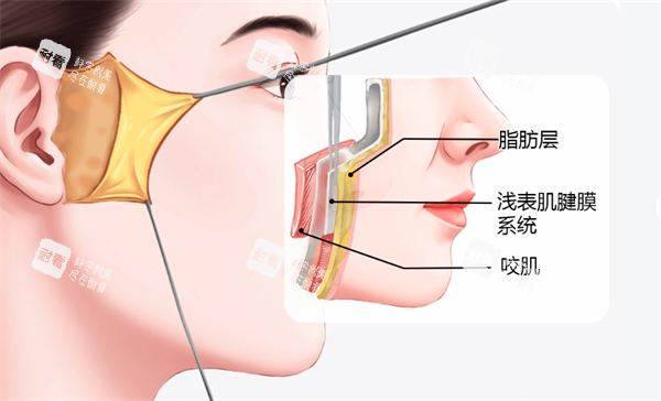 面部拉皮层次 面部拉皮层次