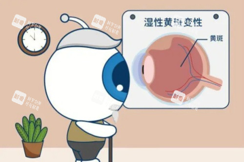 眼睛黄斑病变卡通图 眼睛黄斑病变卡通图