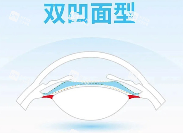 龙晶pr人工晶体双凹面设计