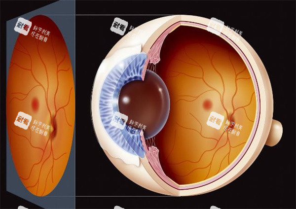 青光眼卡通图展示