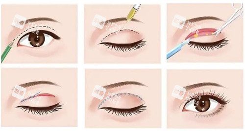 全切过程示意 全切过程示意