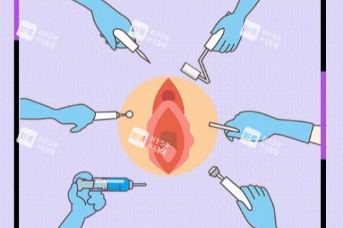 私密整形卡通图