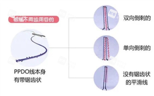 PPDO 线的不同形状