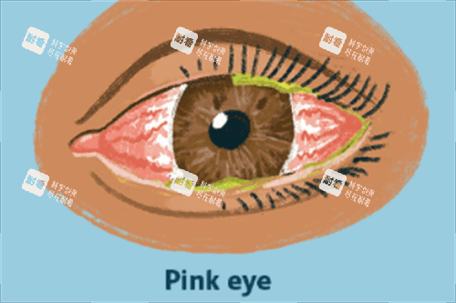 眼睛红肿