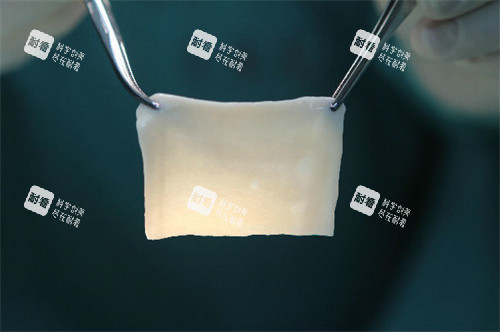 生物补片演示图