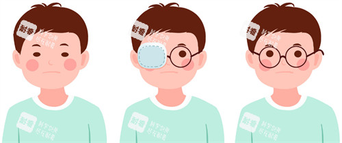 眼睛弱视矫正 眼睛弱视矫正