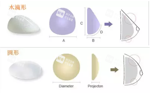 不同形状假体正侧面实物示意图 不同形状假体正侧面实物示意图