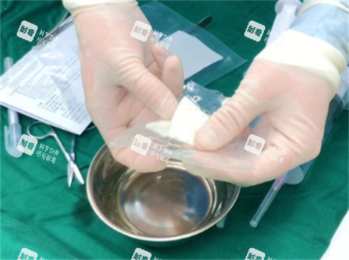 阴茎生物补片包装