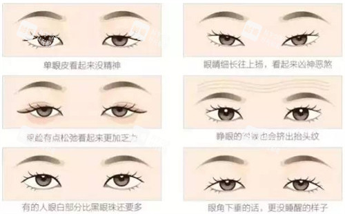 不同可以进行双眼皮的眼睛