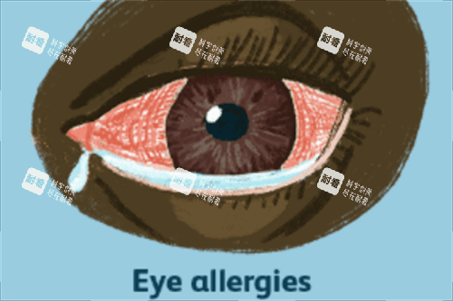 眼睛过敏