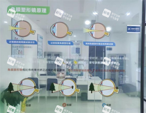 青岛鹿晰眼科角膜塑形镜原理图解区环境图 青岛鹿晰眼科角膜塑形镜原理图解区环境图