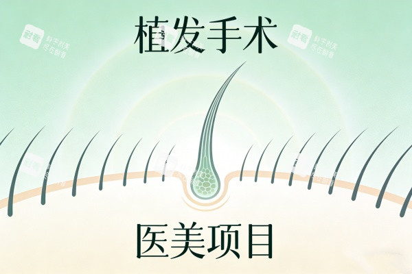 植发手术卡通图展示